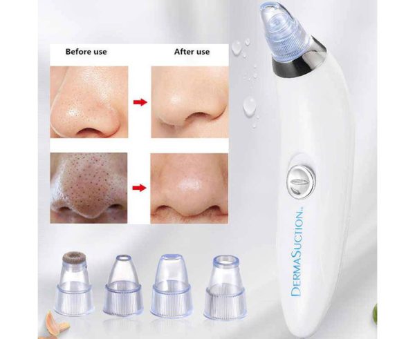 Derma Suction Blackheads Remover Device Skin Purifier (cell Operated)